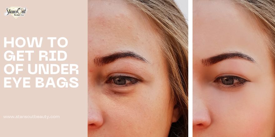 How to Get Rid Of Under Eye Bags - StansOut Beauty Company