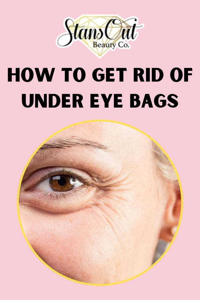 How to get rid of under eye bags